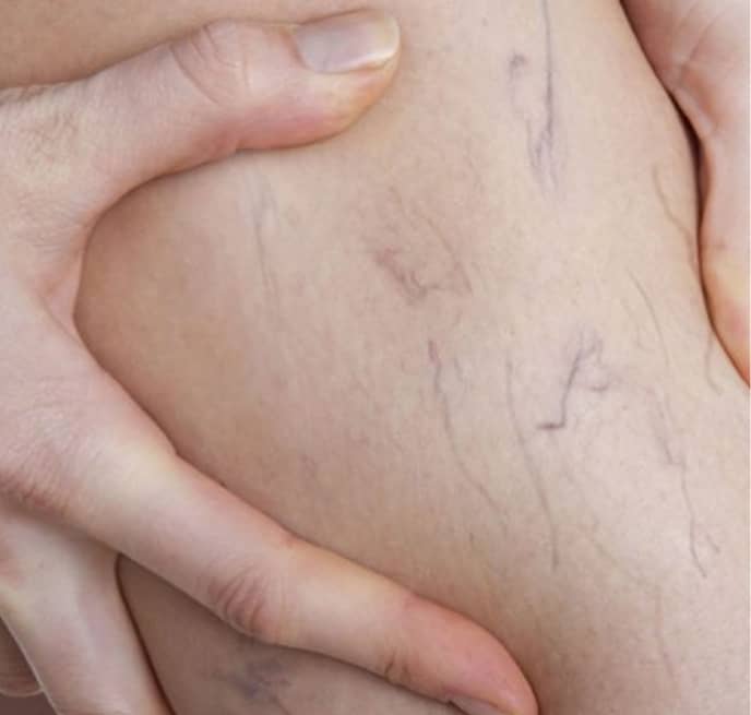 Harvard Trained Vein Doctors | Who is the Best Varicose Vein Dr in NJ?