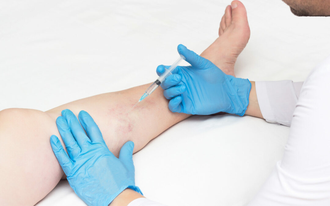 Meet the Best Vein Specialist in Lindenhurst, LI