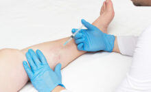 Are you looking for the best vein specialist in Woodland Park? We introduce you to the best vein specialist and the best spider vein and varicose vein clinic in Woodland Park, New Jersey.