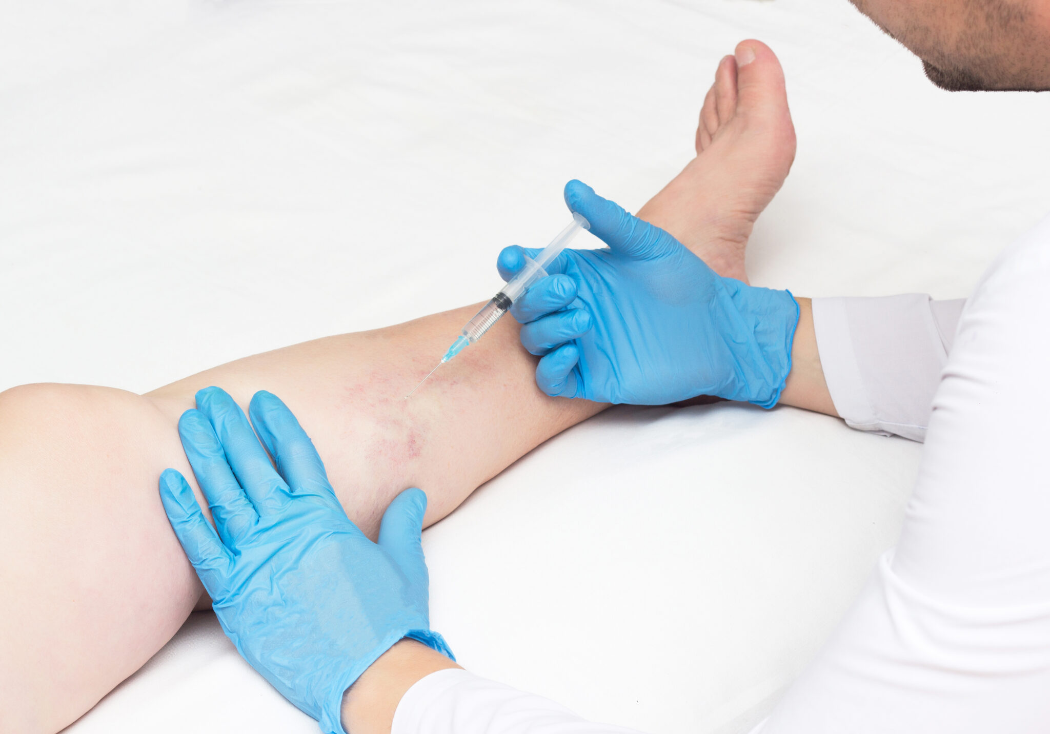 Leg Vein Specialist Near Me