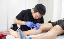 Do you have questions about the minimally invasive spider vein and varicose vein treatment process? The best vein specialist in Clifton describes vein care.