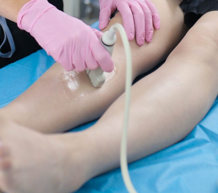 All you need to know about  the Vein Ablation procedure