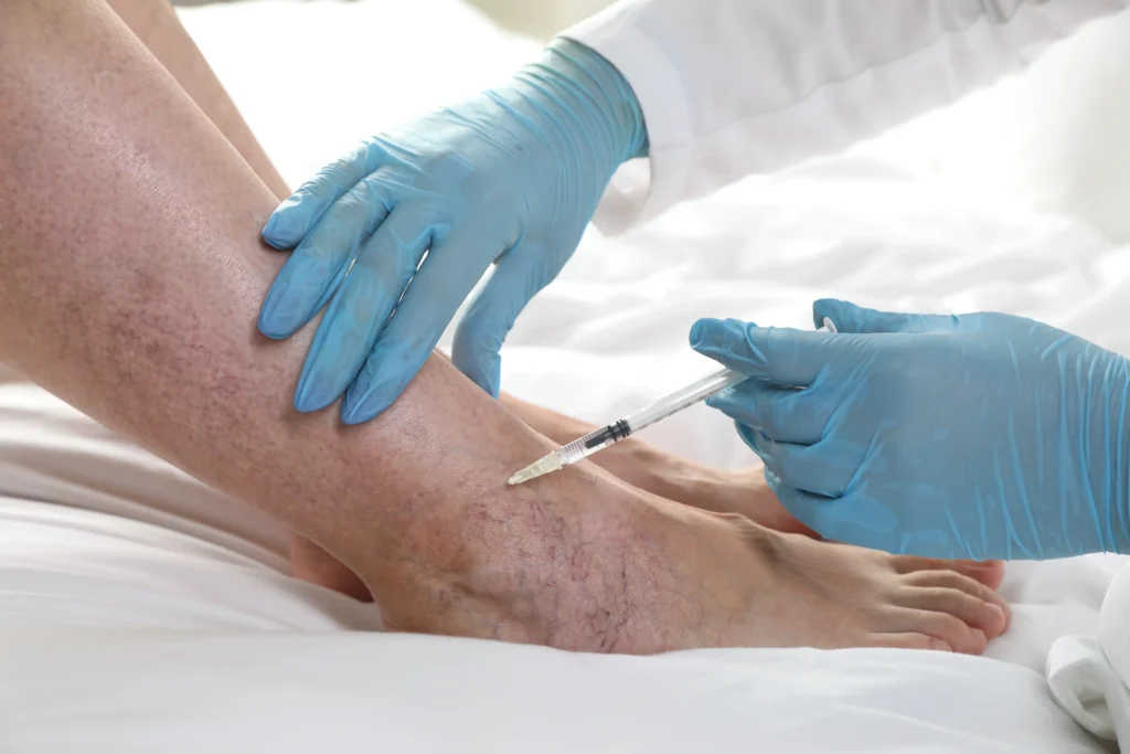 Treat your vein diseases in Cedar Park, TX