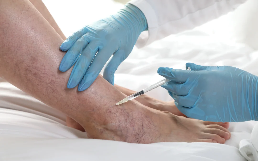 Treat your vein diseases in Cedar Park, TX