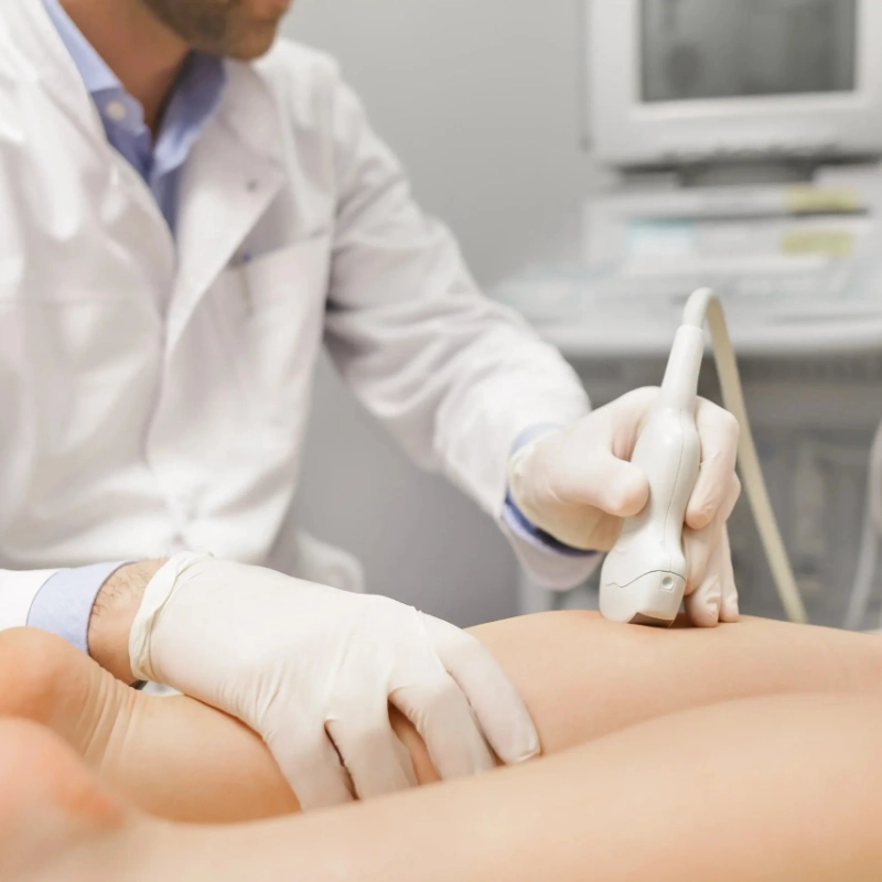 A close-up of a doctor in a white lab coat and white medical gloves performing a venous ultrasound on a patient's leg. The doctor is holding an ultrasound transducer against the skin, and a medical monitor is partially visible in the blurred background.