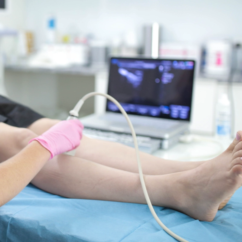 A close-up of a doctor in a white lab coat and white medical gloves performing a venous ultrasound on a patient's leg. The doctor is holding an ultrasound transducer against the skin, and a medical monitor is partially visible in the blurred background.