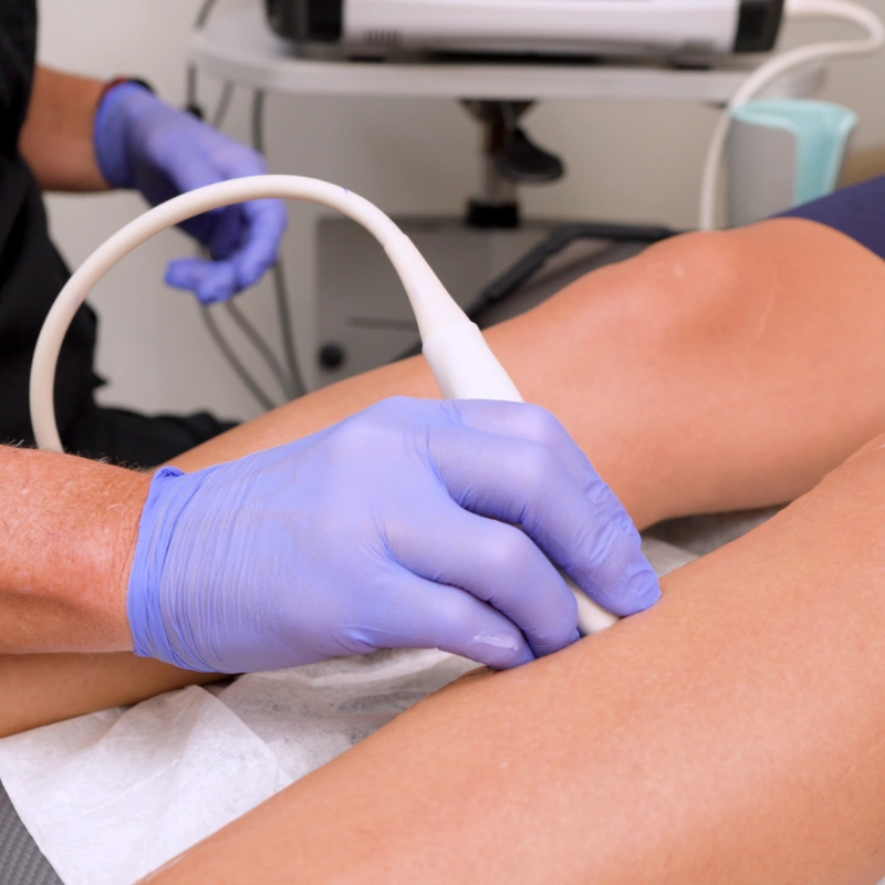 A healthcare provider wearing purple nitrile gloves performs a Duplex Ultrasound examination on a patient's arm using an Ultrasound Machine. The provider holds the Ultrasound Probe against the patient's skin in a clinical setting with medical equipment visible in the background.